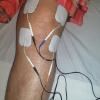 Terapia física y rehabilitación 